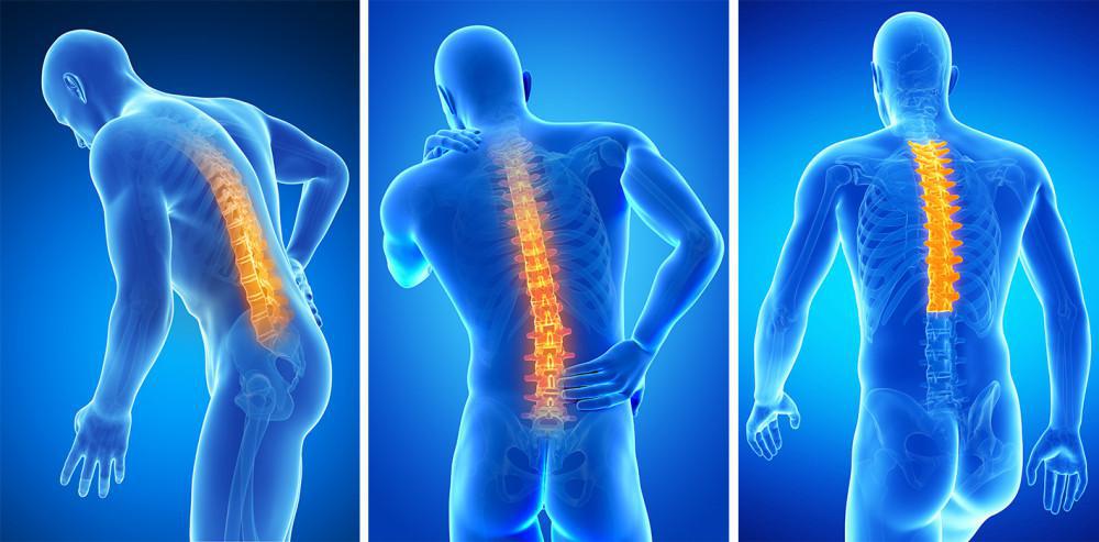 Lumbar Injection Therapy