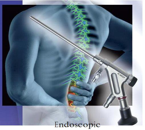 endoscopic